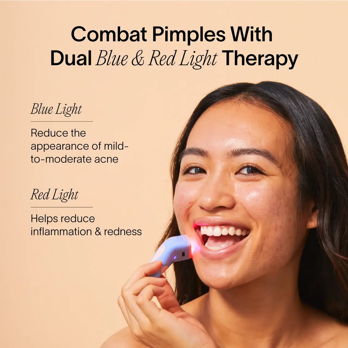 شخص يستخدم جهاز Solawave Bye Acne: 3 دقائق لعلاج البثور على وجهه مبتسمًا. يسلط النص الضوء على الفوائد: يكافح العلاج المزدوج بالضوء الأزرق والأحمر البثور؛ يقلل الضوء الأزرق من حب الشباب، بينما يهدئ الضوء الأحمر من الالتهاب والاحمرار. خلفية باللون البيج.